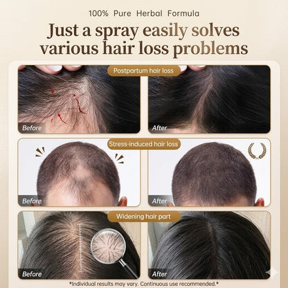 🌿 Minoxidil Keratin Hair Spray 🌱 Herbal Formula ✨ Healthy Hair Care for the Whole Family-EQ