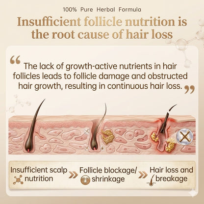 🌿 Minoxidil Keratin Hair Spray 🌱 Herbal Formula ✨ Healthy Hair Care for the Whole Family-EQ