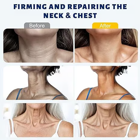 🔥Roller Massage Neck Cream 🧴 Collagen & Hyaluronic Acid | Firms Neck, Reduces Wrinkles & Double Chin-JKL