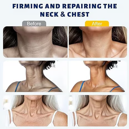 🔥Roller Massage Neck Cream 🧴 Collagen & Hyaluronic Acid | Firms Neck, Reduces Wrinkles & Double Chin-JKL